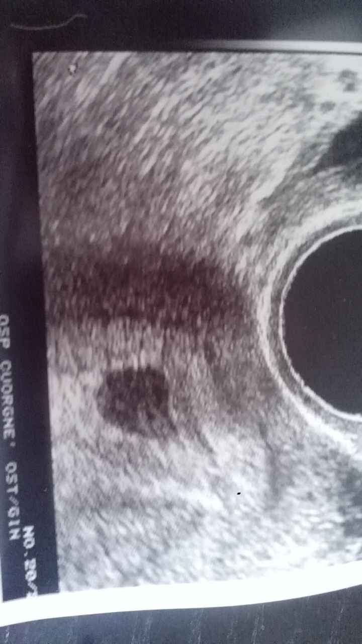 Aggiornamenti sul nostro millimetro - 1