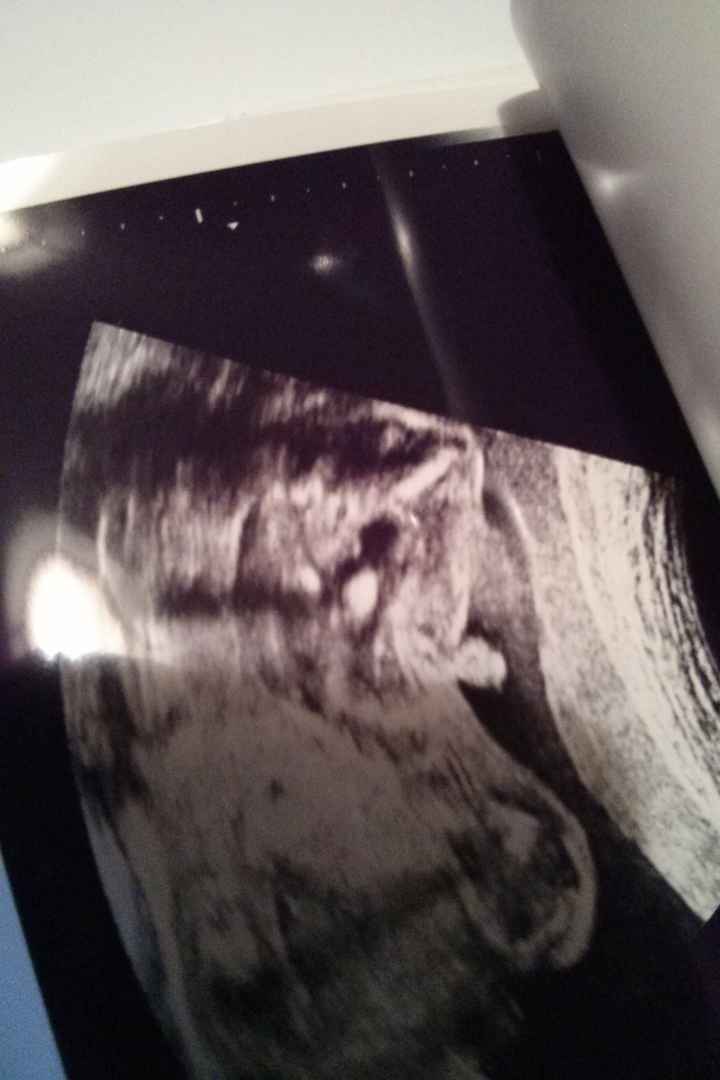 Un feto senza pudore! - 1