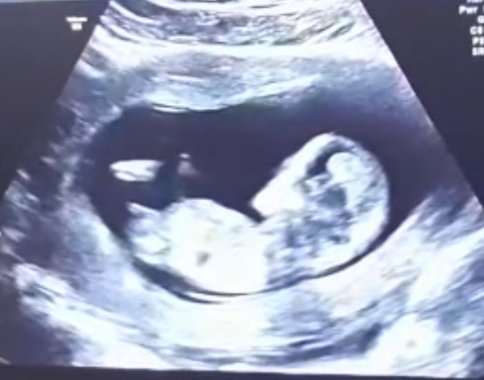 Mamme luglio 2020 1