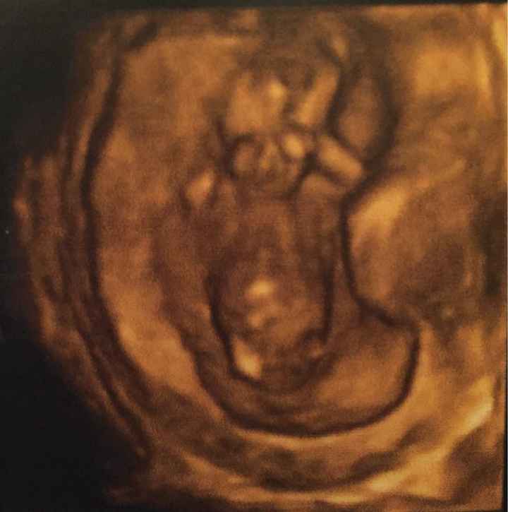Prima ecografia - 1