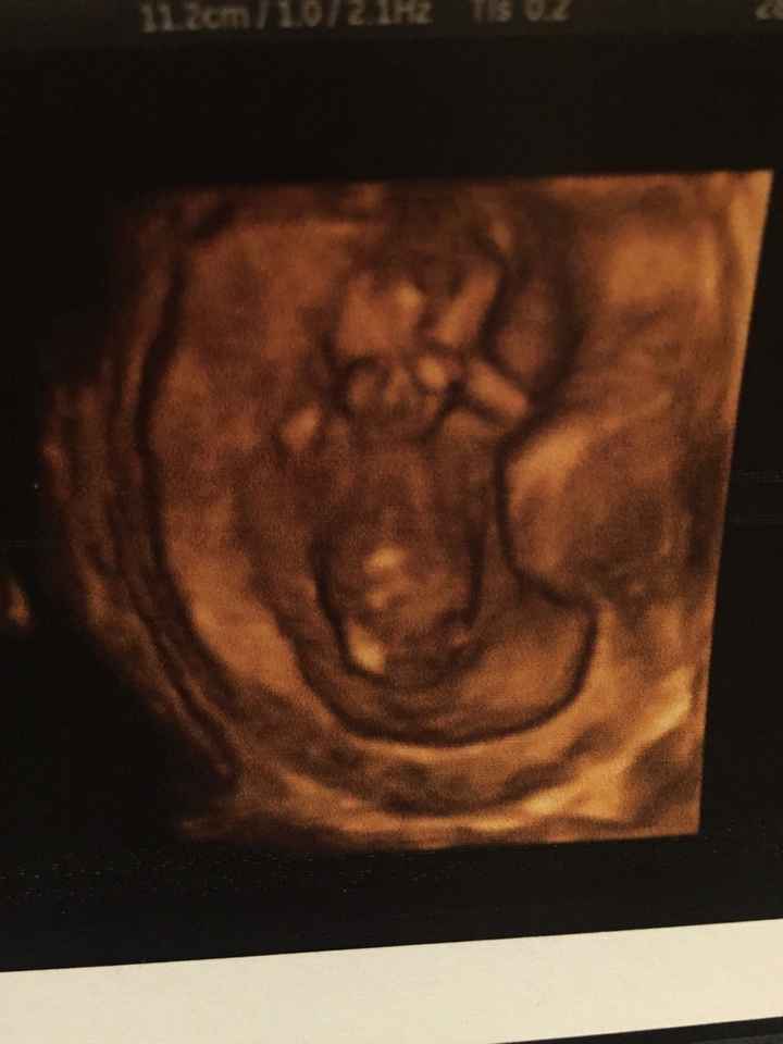 I bellissimi profili dei nostri bimbi in pancia? - 1