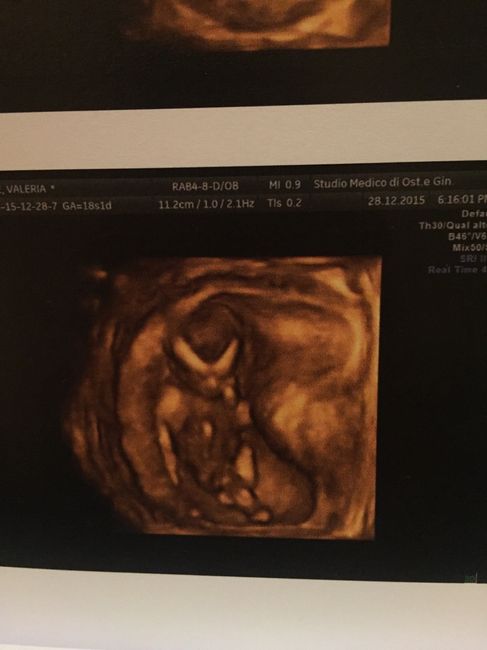 13+1 e translucenza - 2