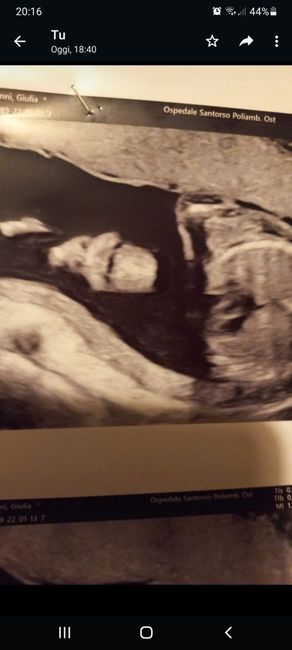 Future Mamme Giugno 2022 ❤❤❤ - 1