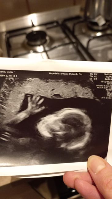 Future Mamme Giugno 2022 ❤❤❤ - 1