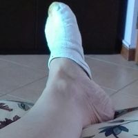 Mancano 27 gg e io sono bloccata dal mio piedone - 2