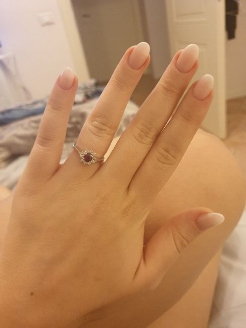 Anello findazamento - 1