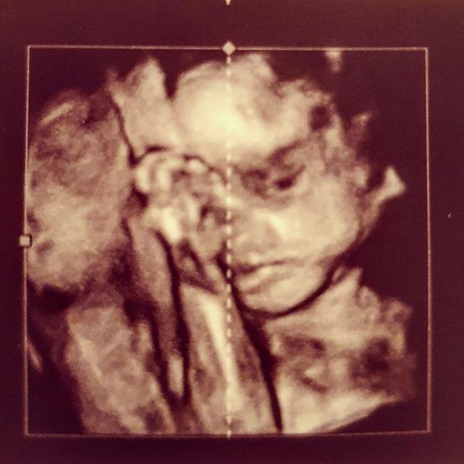 Future mamme di Aprile 2021 🐣 3