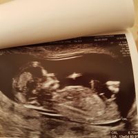 Chi conosce la Nub Theory? 💙o💖? - 1