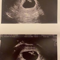 Metodo Ramzi 😂😉❤️ - 1