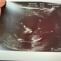 Future mamme ottobre 2022 - 1