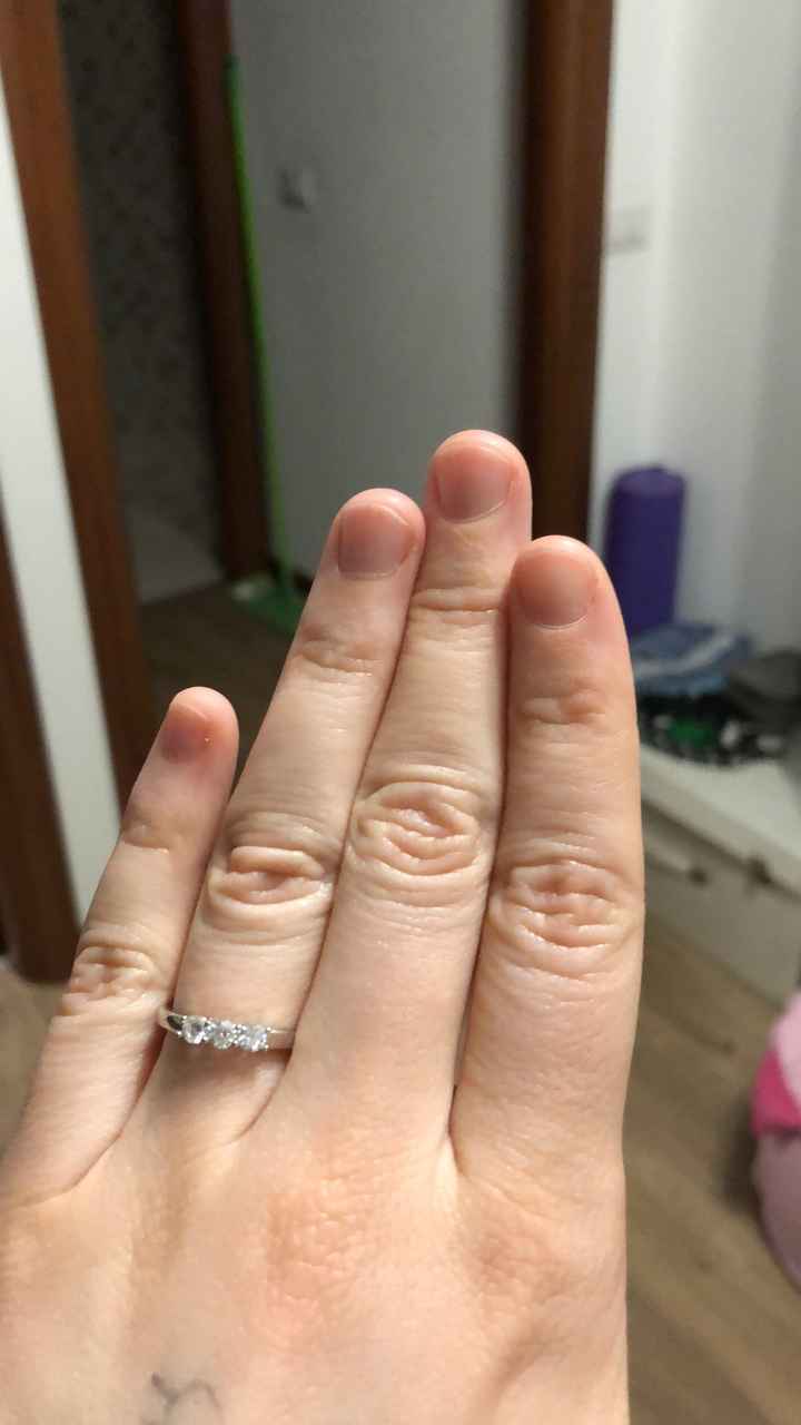 E ora mostraci una foto del tuo anello di fidanzamento! - 1