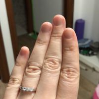 E ora mostraci una foto del tuo anello di fidanzamento! - 1