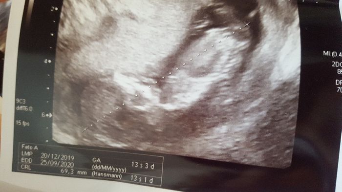 Ramzi ne ha beccate 2 su 2❤️❤️ - 1