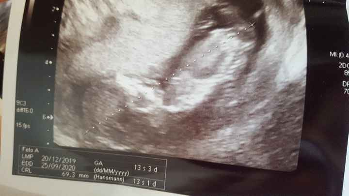 Ramzi ne ha beccate 2 su 2❤️❤️ - 1