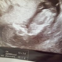 Ramzi ne ha beccate 2 su 2❤️❤️ - 1