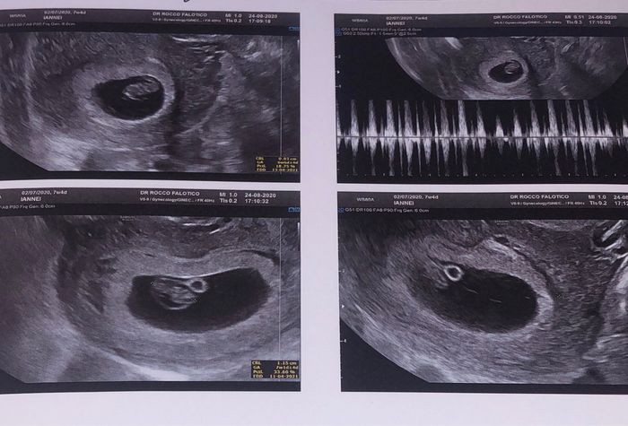 Metodo ramzi chi ne capisce?? - 1