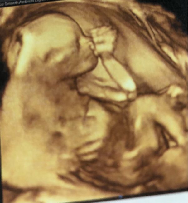 Future mamme di Aprile 2021 🐣 - 1