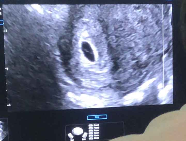 Future mamme di Aprile 2021 🐣 - 1