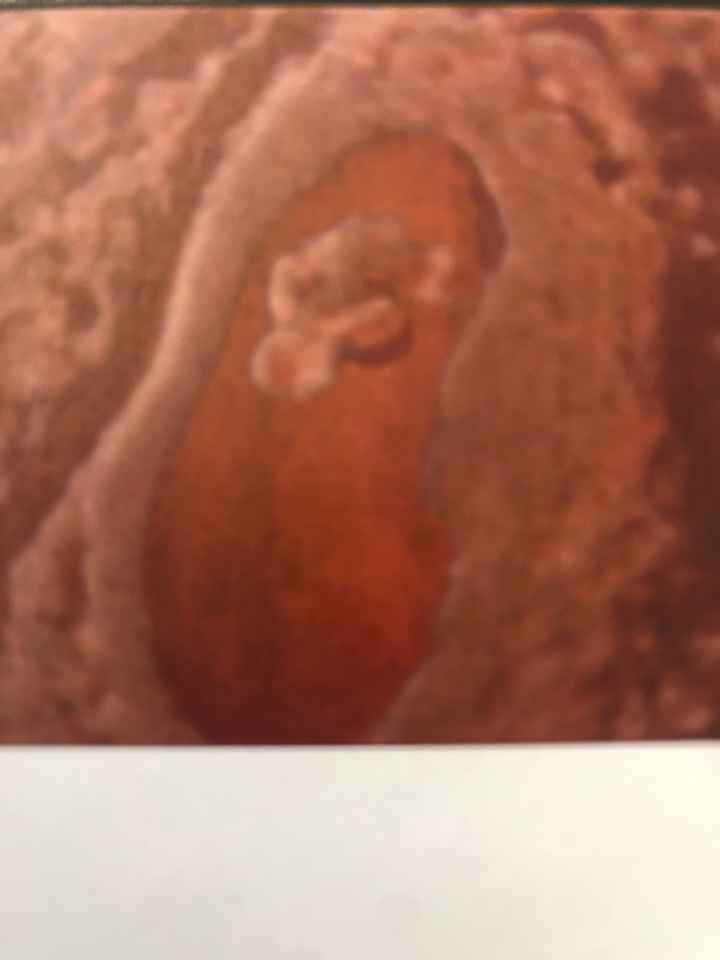 Future mamme di Aprile 2021 🐣 - 2