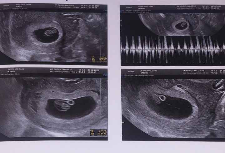 Metodo ramzi chi ne capisce?? - 1