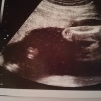 Future mamma settembre 2019 - 1