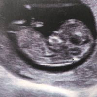 Future mamme di Aprile 2021 🐣 - 1