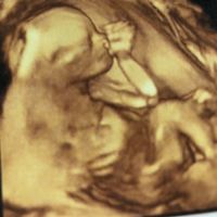 Future mamme di Aprile 2021 🐣 - 1