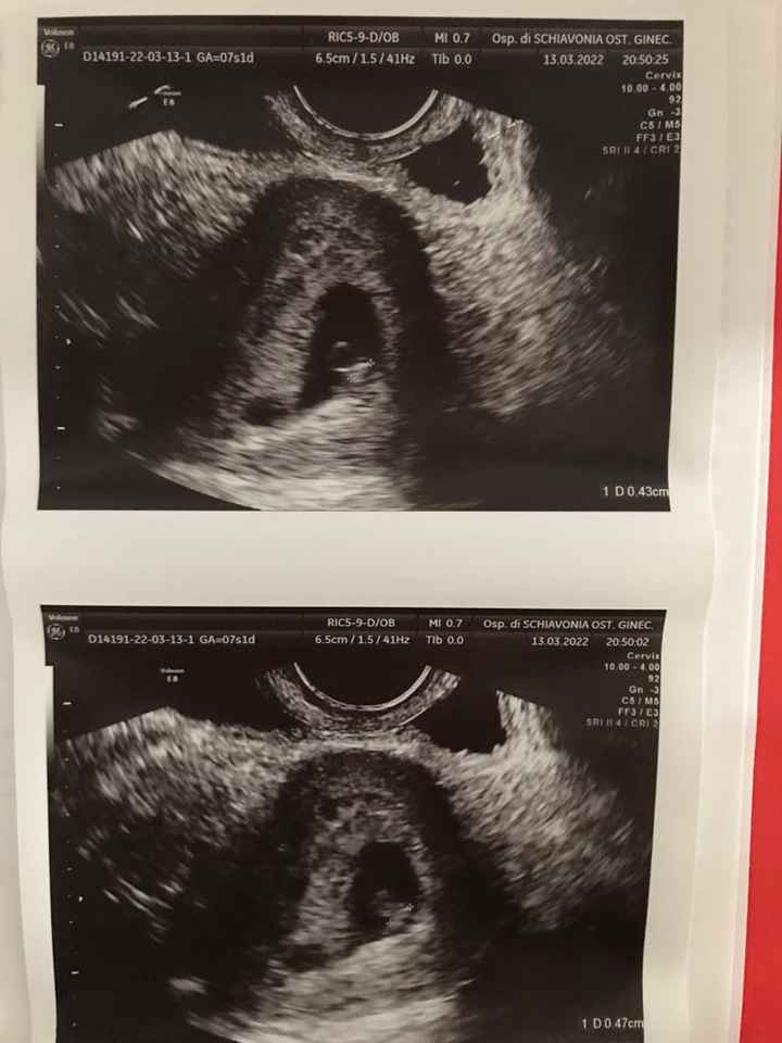 Future mamma novembre 2022 🍇🍁🧸 - 1