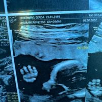 Future Mamme Giugno 2022 ❤❤❤ - 1