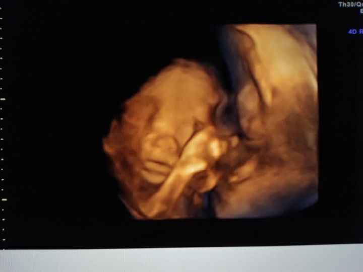 Morfologica, che spettacolo!!!! - 3