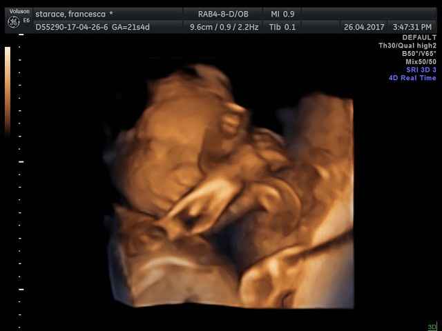 Morfologica, che spettacolo!!!! - 5