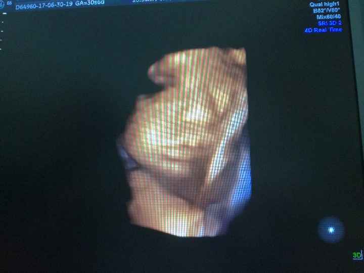 Eco di accrescimento! guardate che labbra! sempre piu polpetta!😍 - 1