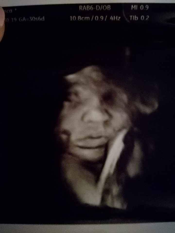 Eco di accrescimento! guardate che labbra! sempre piu polpetta!😍 - 3