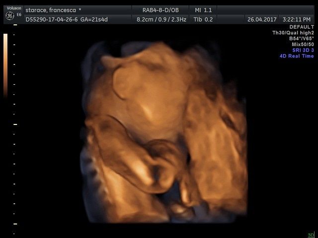 Morfologica, che spettacolo!!!! - 2