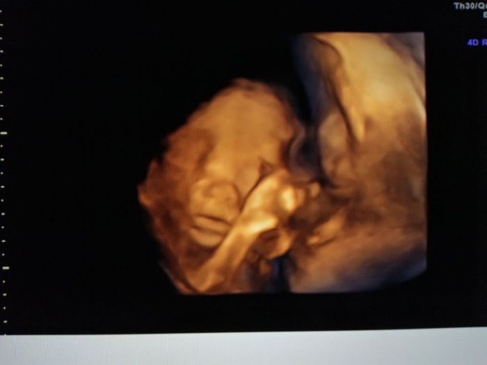 Morfologica, che spettacolo!!!! - 3