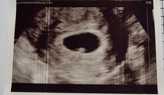 Prima ecografia! ❤️ 2