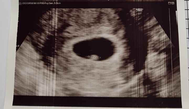 Prima ecografia! ❤️ - 1