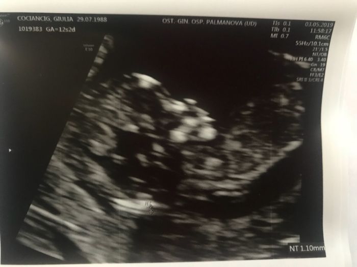 Future mamme di novembre 2