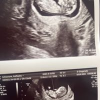 Nub theory, giochiamo un po’ - 1