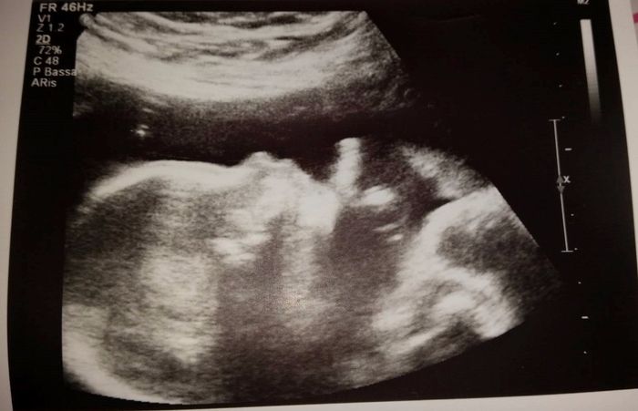 Ilaria 25 wk
