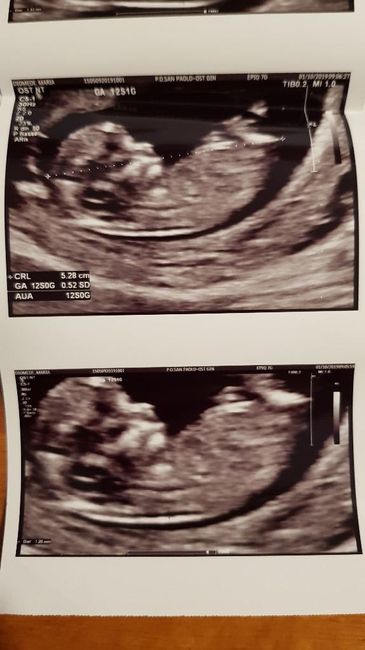 Esperte Nub Theory - 1