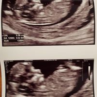 Esperte Nub Theory - 1