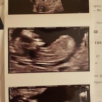 Esperte Nub Theory - 2