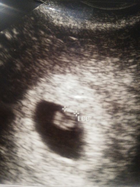 Future mamme novembre 2020 🌞🍁🌷♾ - 1