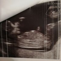 Future mamme novembre 2020 🌞🍁🌷♾ - 1