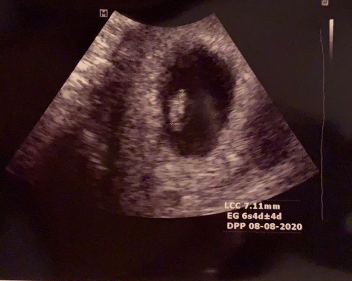 Mamme di Agosto 2020😍🤞😍 - 1