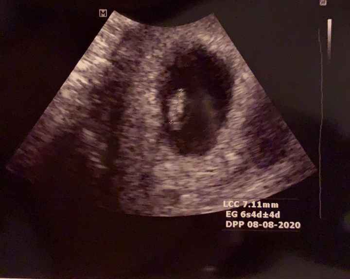 Mamme di Agosto 2020😍🤞😍 - 1