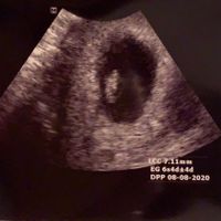 Mamme di Agosto 2020😍🤞😍 - 1