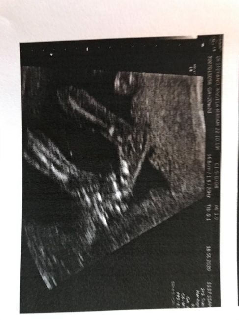 Future mamme novembre 2020 🌞🍁🌷♾ - 2