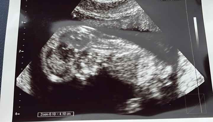 Nub theory. Maschio o femmina?💙🎀 - 1